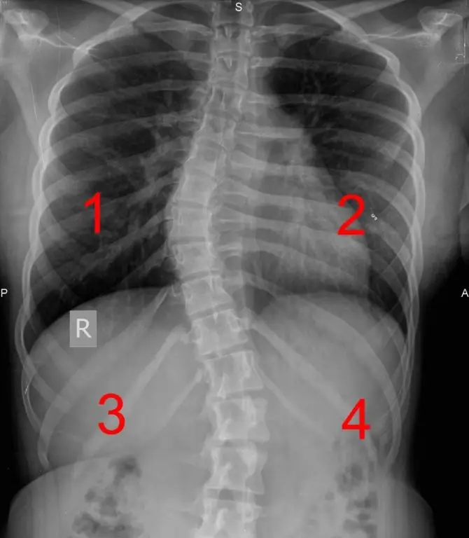 quadrant-spine