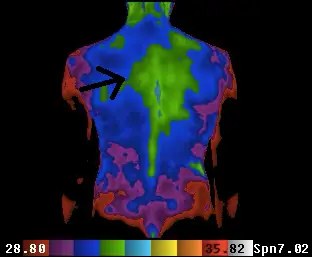 thermal scan no arrow