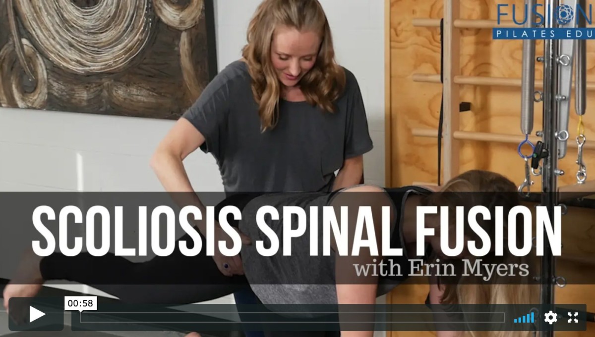 erin myers title card for scoliosis spinal fusion training