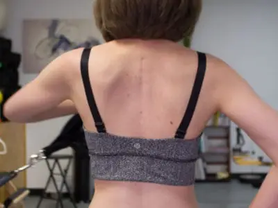 Scoliosis in adults treatment at Spiral Spine Nashville