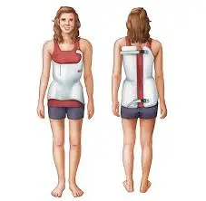 cartoon white woman wearing a back brace for scoliosis