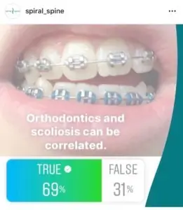 orthodontic braces can cause scoliosis