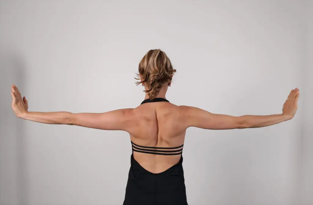 Erin Myers' scoliosis showing