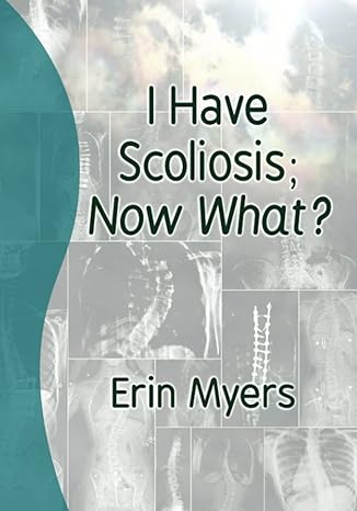 I have Scoliosis; Now What? Book